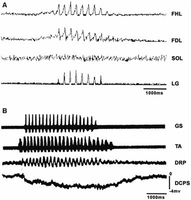 Fictive Scratching Patterns in Brain Cortex-Ablated, Midcollicular Decerebrate, and Spinal Cats